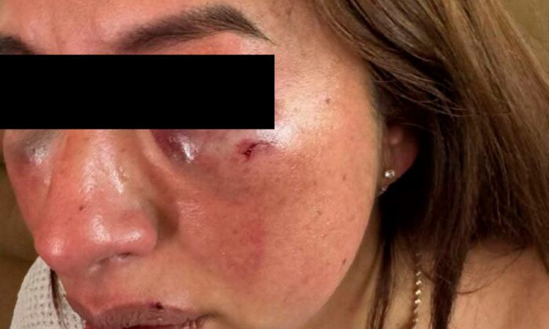 Acusan de violación a alcaldesa de municipio de Edomex